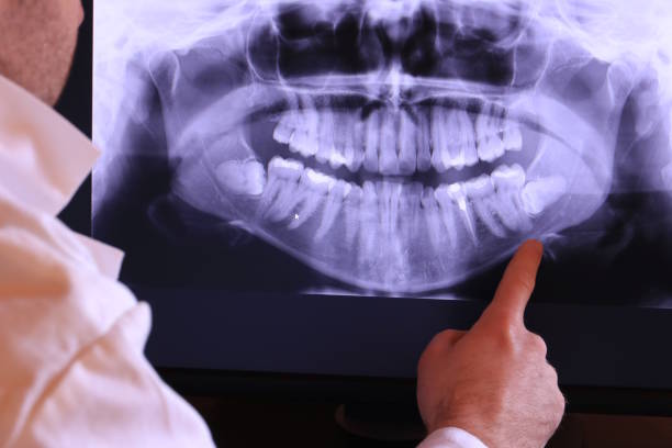 Best Emergency Root Canal Treatment in Cusseta, GA