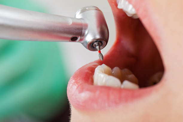 Best Broken or Cracked Tooth Emergency Dentist in Cusseta, GA